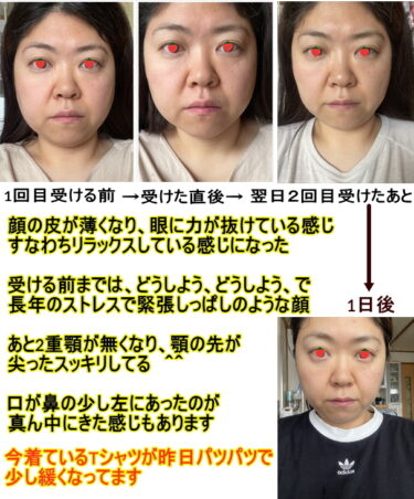 人間関係のストレスで過食気味の顔がヒーリングで浮腫み無くなる!美容やダイエットヒーリングとの違い