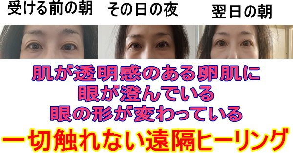 眼が綺麗になったビフォーアフター写真