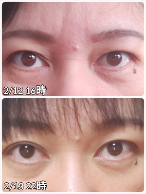 1000円ヒーリングでの目の変化