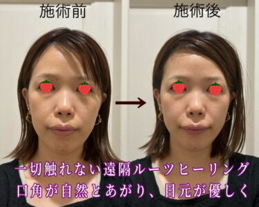 ルーツヒーリング２回での変化