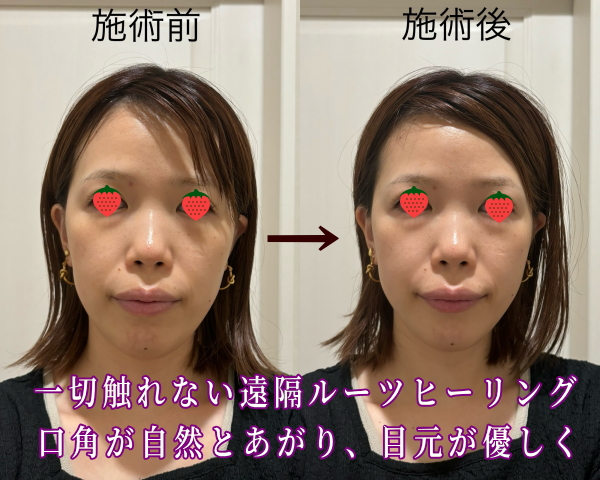 ルーツヒーリング２回での変化