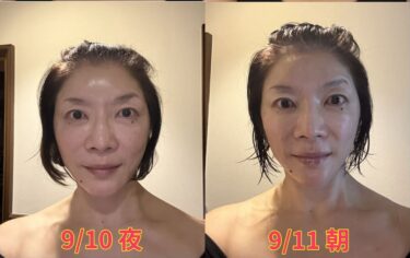 2回目の美容整体で眼の眼光輝いた写真