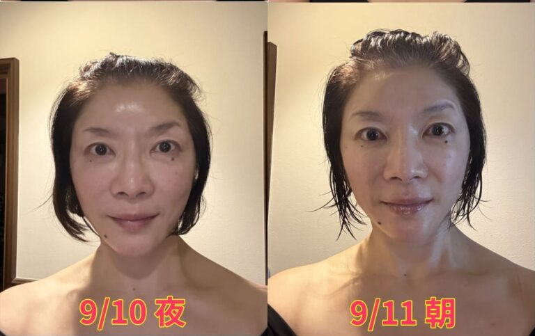 2回目の美容整体で眼の眼光輝いた写真